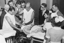 Операція, якою люди боялися століттями: 10 фактів про лоботомію