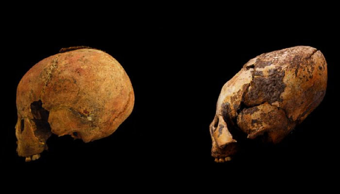 У Китаї археологи виявили скелети з яйцеголовими черепами – 2