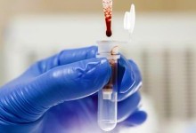 8 фактів про вашу кров, які знають лише одиниці: ви про це навіть не здогадувалися