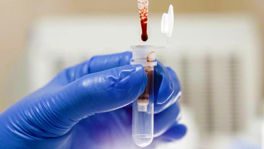 8 фактів про вашу кров, які знають лише одиниці