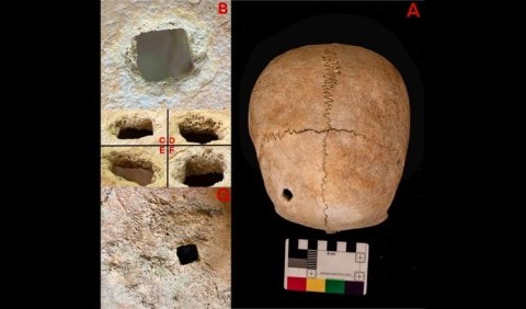 Радикальна медицина: навіщо 4000 років тому в Італії дівчину поховали з цвяхом у голові?