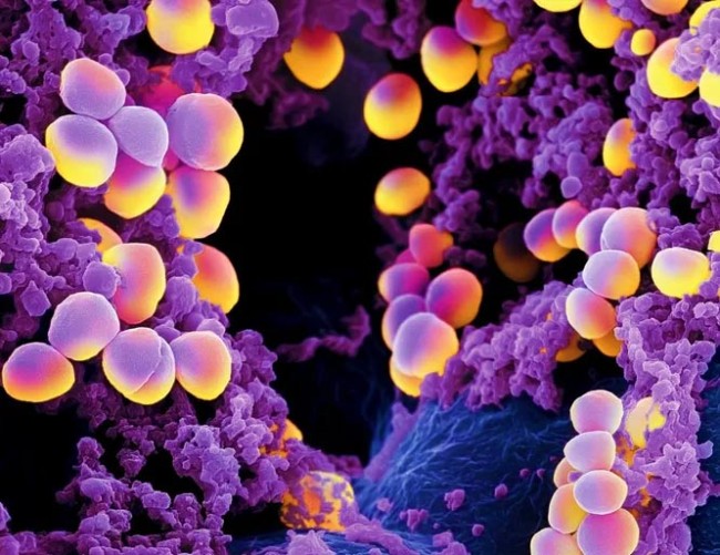 ТОП-10 найнебезпечніших бактерій – 7