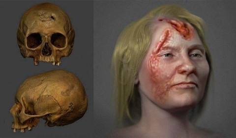 Відновлено вигляд середньовічної жінки, яка страждала від сифілісу