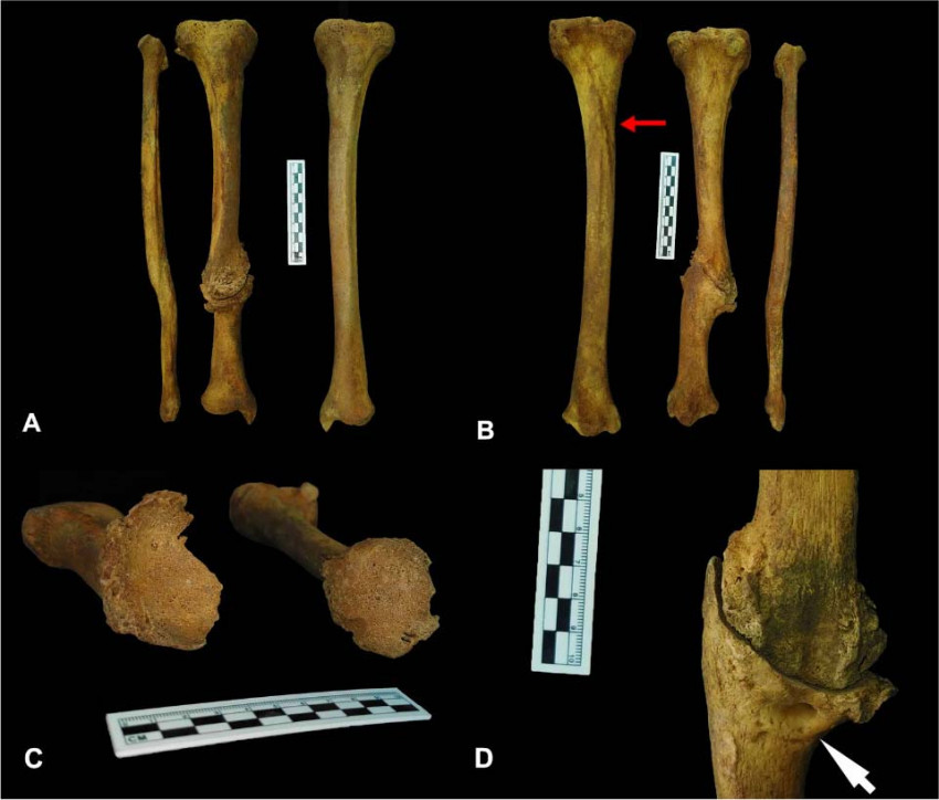 Стародавні кістки з Китаю, обстежені палеопатологами