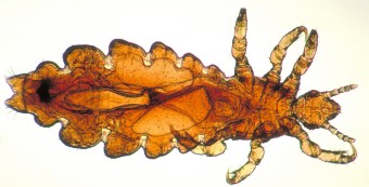 Головна воша (Pediculus humanus capitis capitis)
